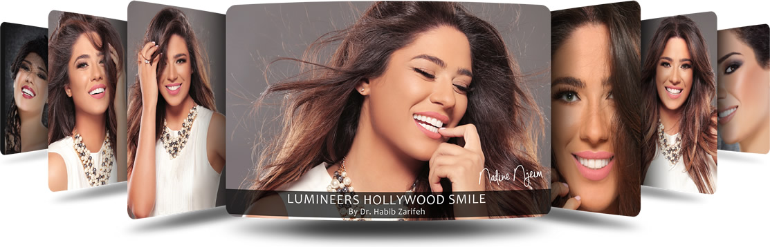 lumineers veneers dubai - Hollywood Smile